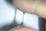 揭秘女性健康白带异常现象的深度解析