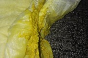 新生儿拉稀是什么症状
