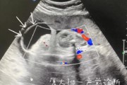 怀孕两个月胎儿发育情况
