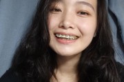 整牙出国不能复诊